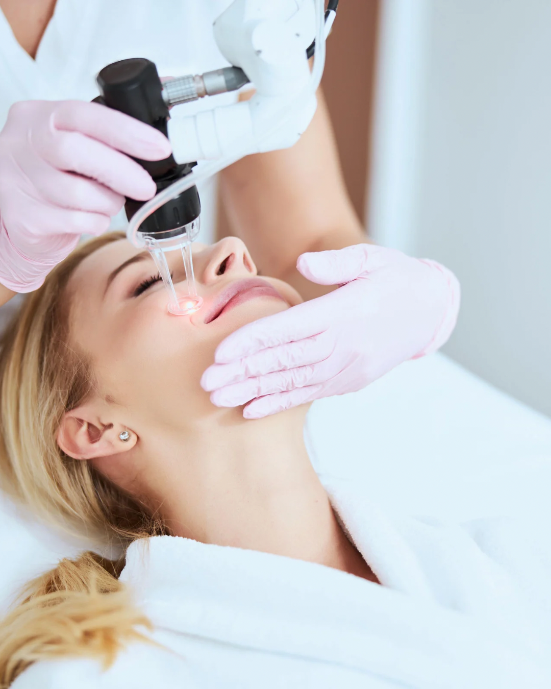 Co2 laser skin resurfacing in dubai for acne scars, uneven skin, stretch marks and wrinkles.