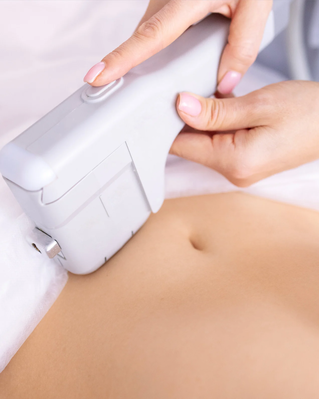 HIFU SMAS lifting in dubai for lifting saggy skin and body contouring.