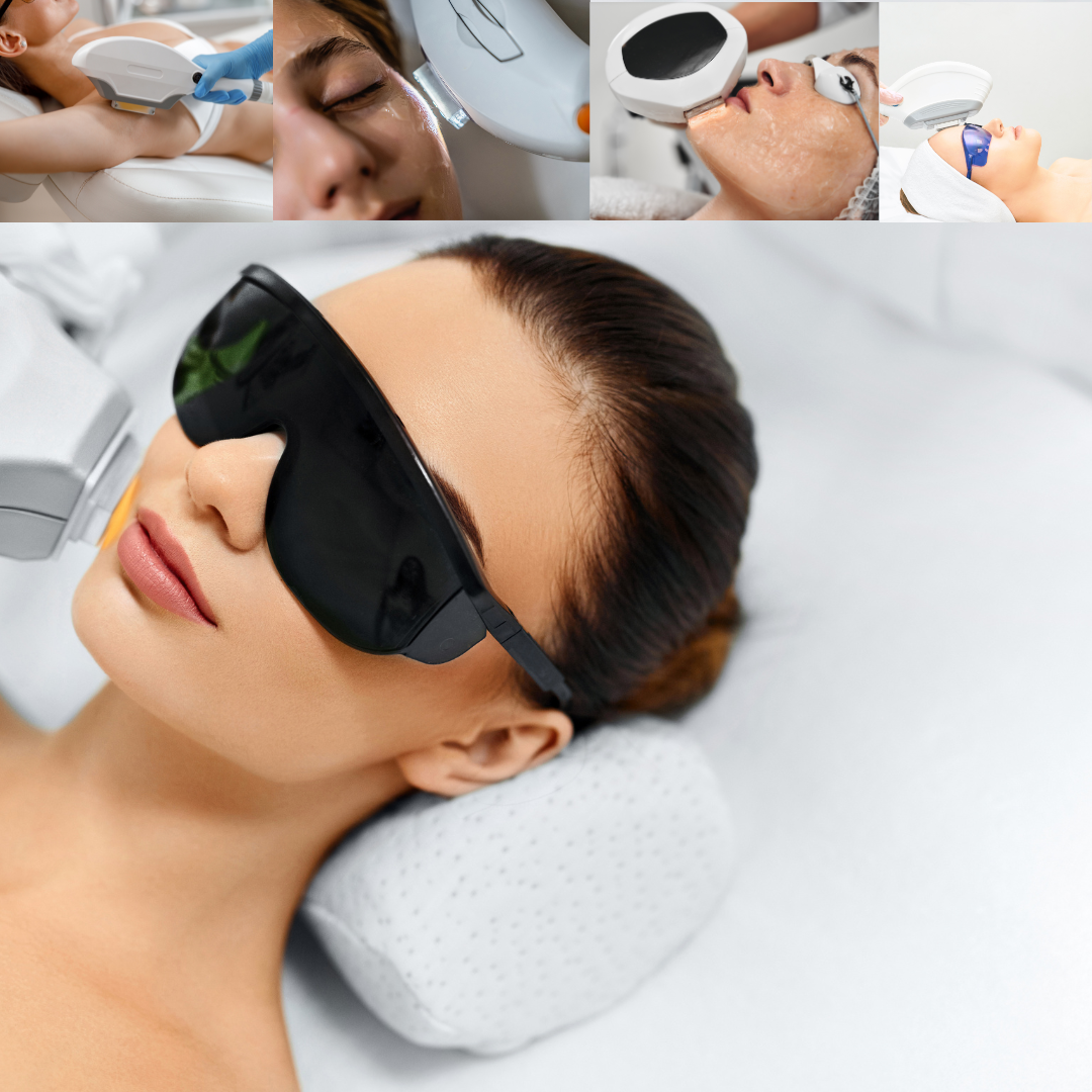 Refined illustration of advanced laser technology rejuvenating a Caucasian complexion.